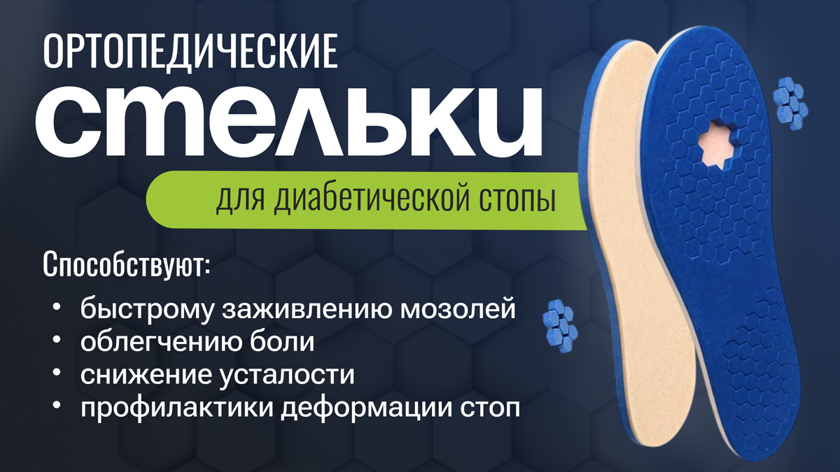 Индивидуальные ортопедические стельки